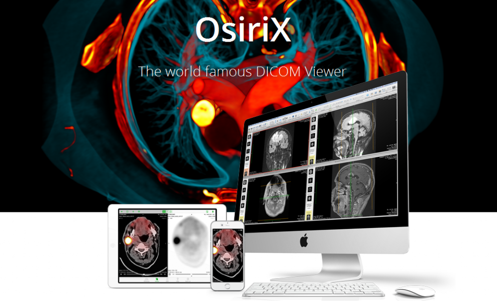 get download link for osirix lite for windows
