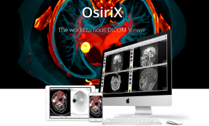 osirix lite remove not for medical usage